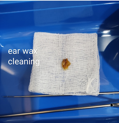 Dr Benjamin Goh Ipoh ENT Specialist (Pakar Hidung Telinga Tekak Ipoh)