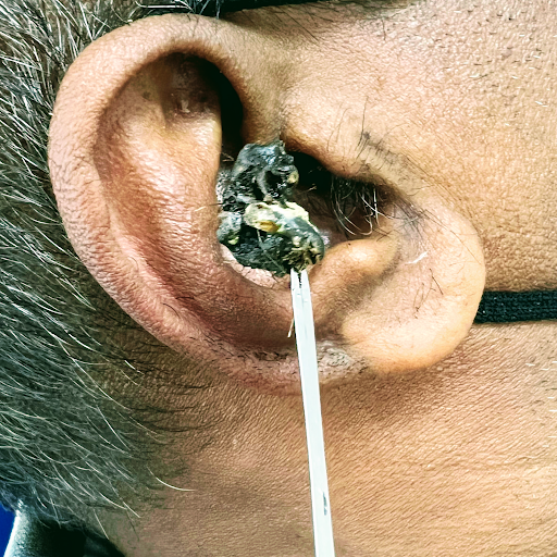 Dr Kay KPJ Kajang Ear Nose Throat (ENT) Head & Neck, Thyroid Surgery Specialist Klinik Hidung Tekak & Telinga 恺医生耳鼻喉专科诊所