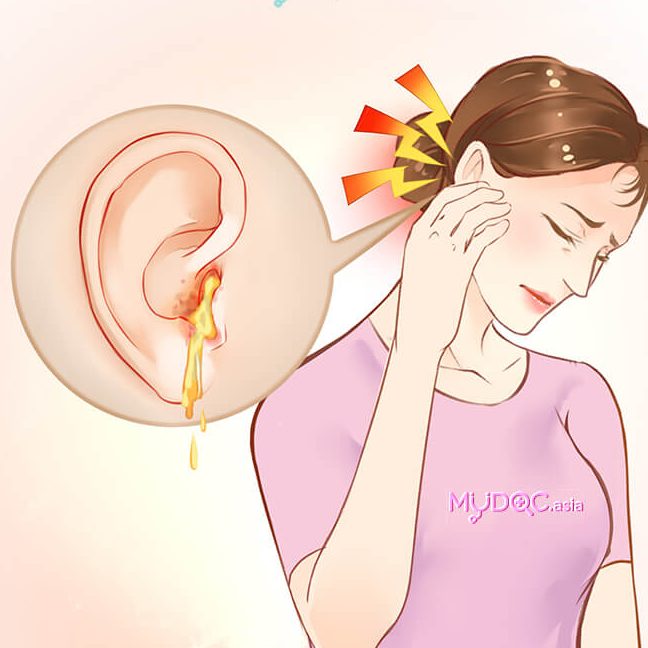 klinik telinga en miri terbaik dan berpengalaman