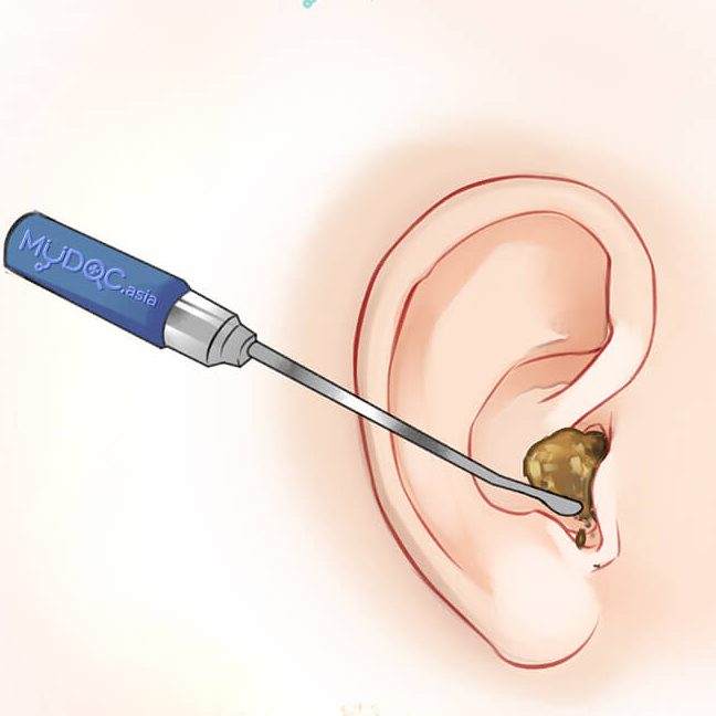 klinik telinga terbaik di kampung pasir gudang baru