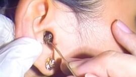 klinik telinga terbaik di lahad datu