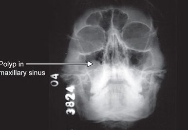 poliklinik mallal ent gp