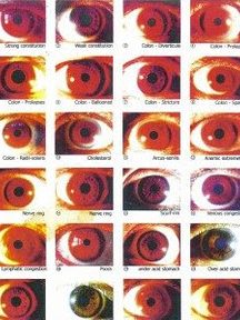 pusat rawatan iridology